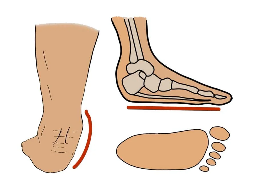 Blog Exercising Health Barefoot Strength